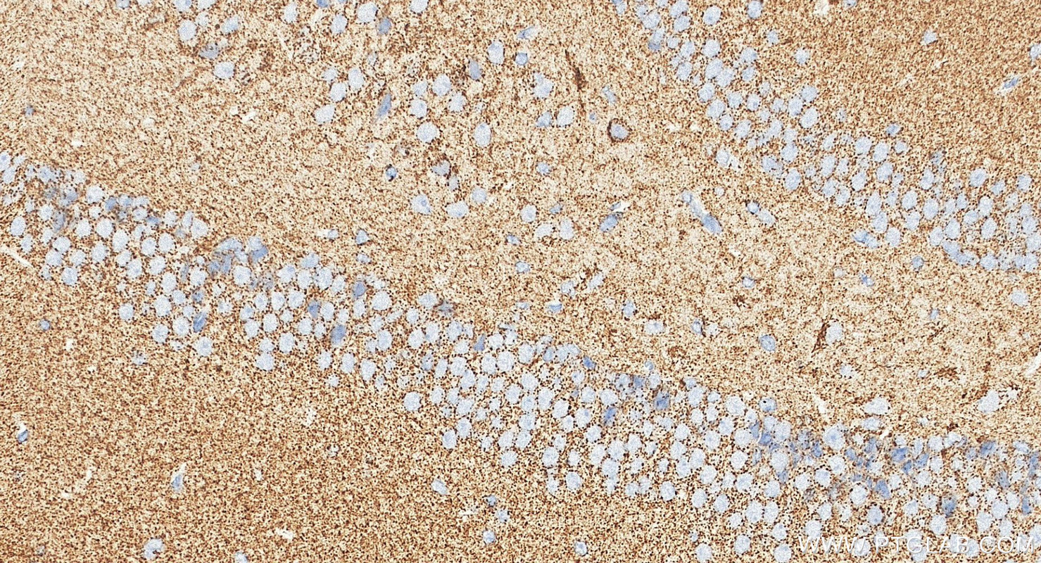 IHC staining of mouse brain using 17079-1-AP