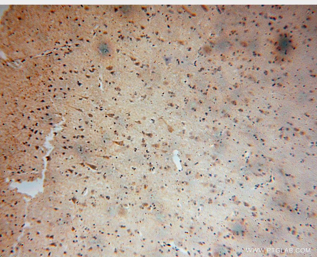 IHC staining of human brain using 17079-1-AP