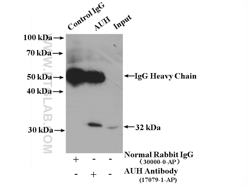 IP experiment of HeLa using 17079-1-AP