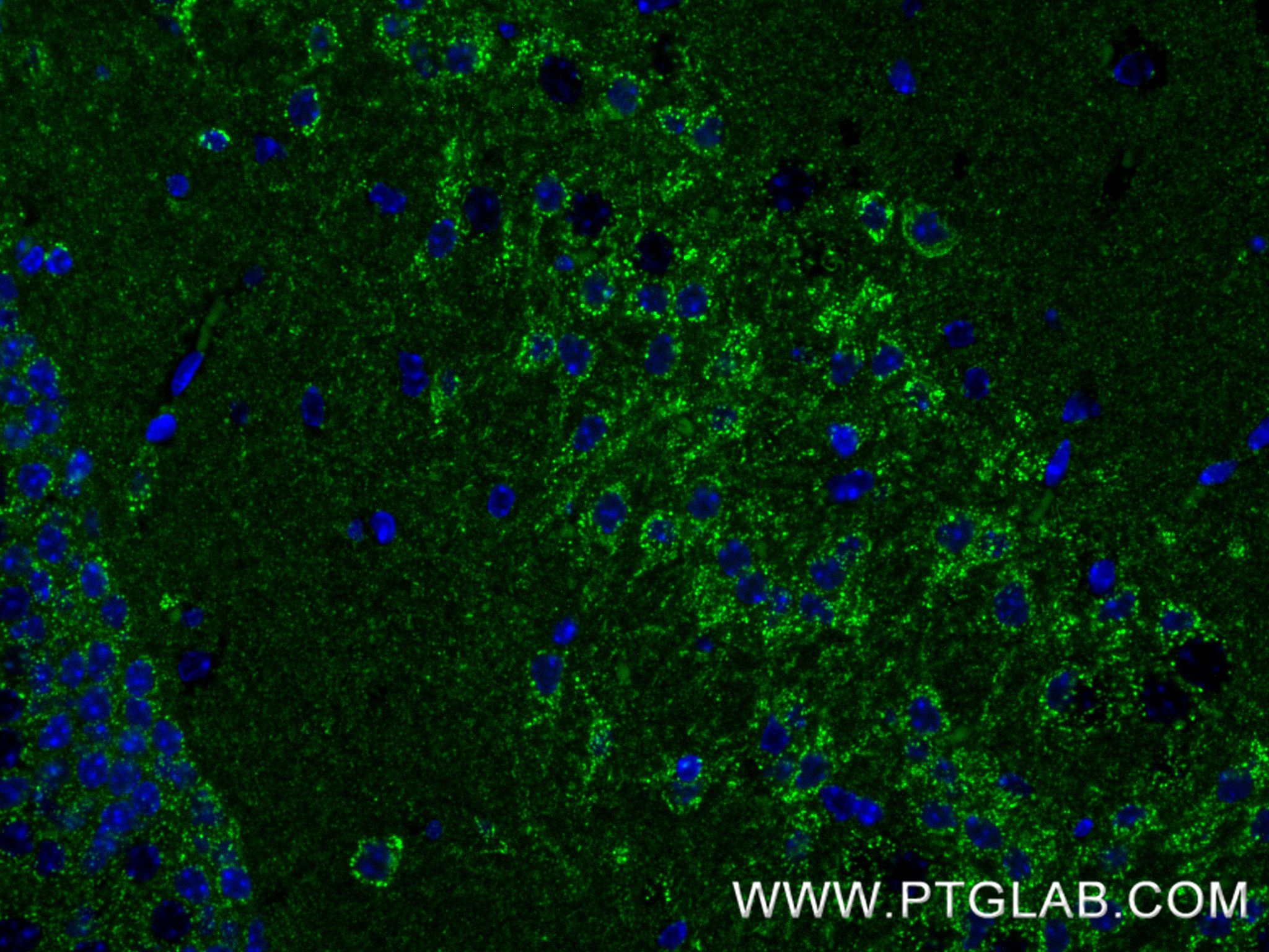 IF Staining of mouse brain using 85421-1-RR
