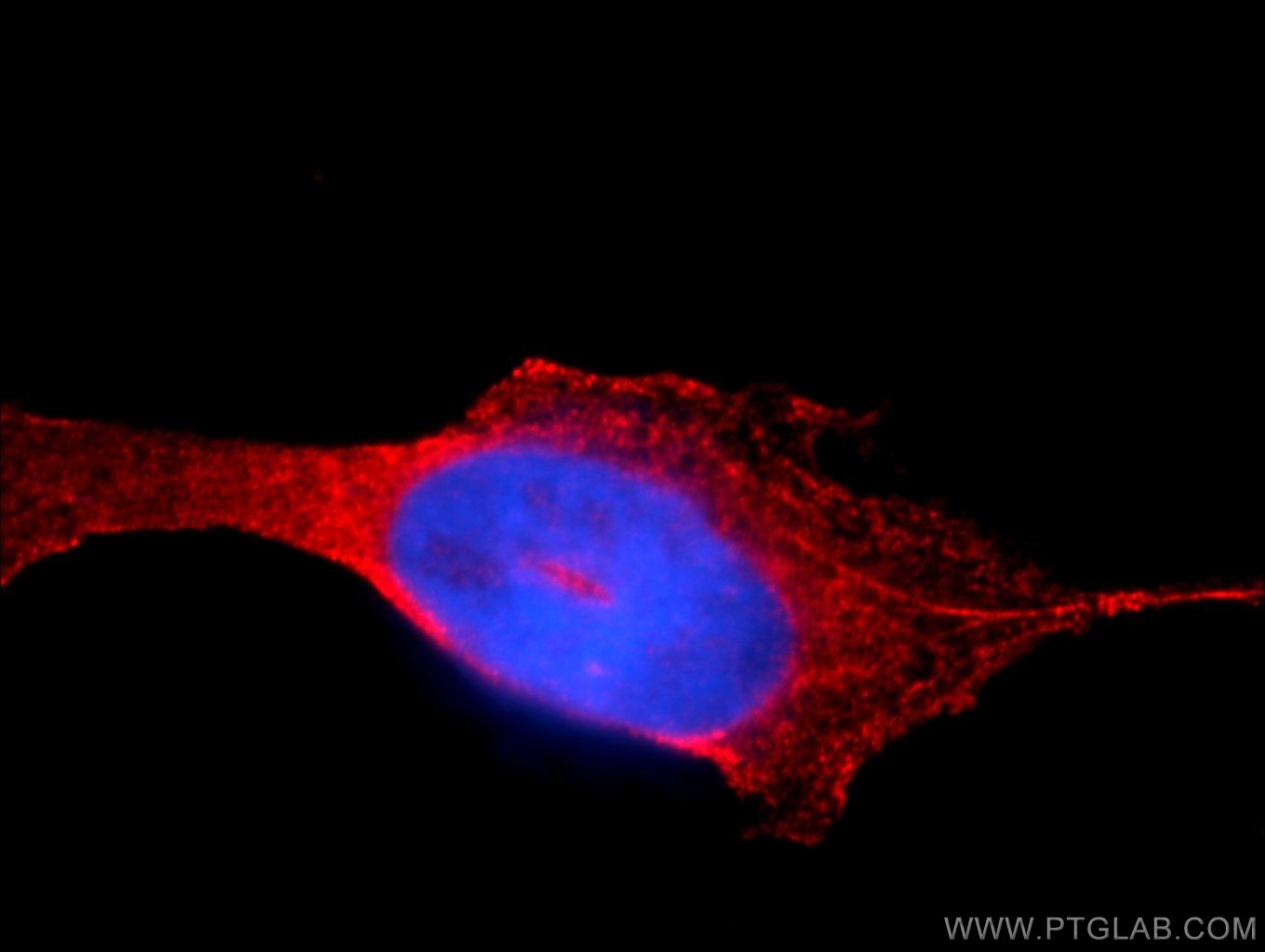 IF Staining of A431 using 13726-1-AP