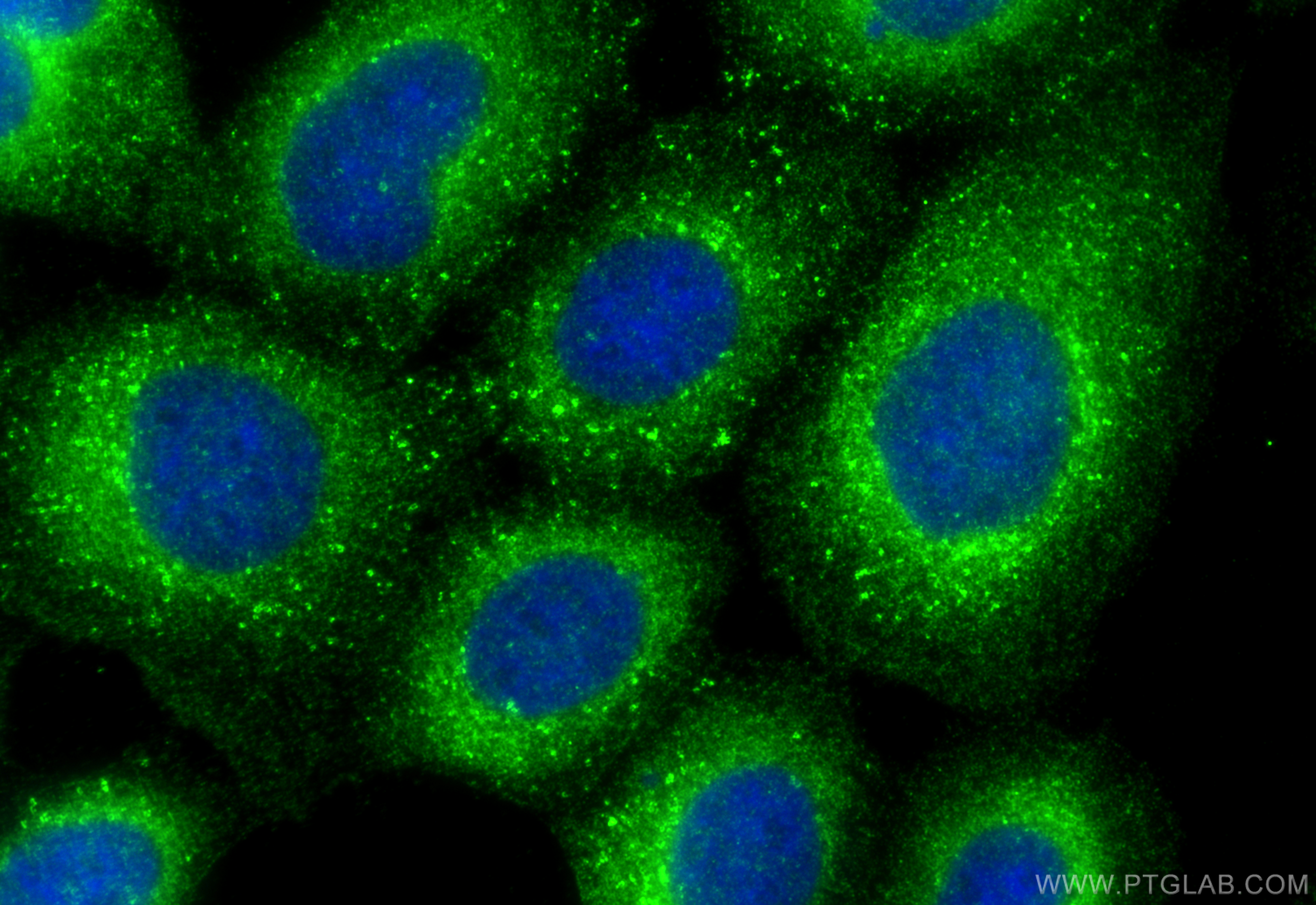 IF Staining of A431 using 13726-1-AP