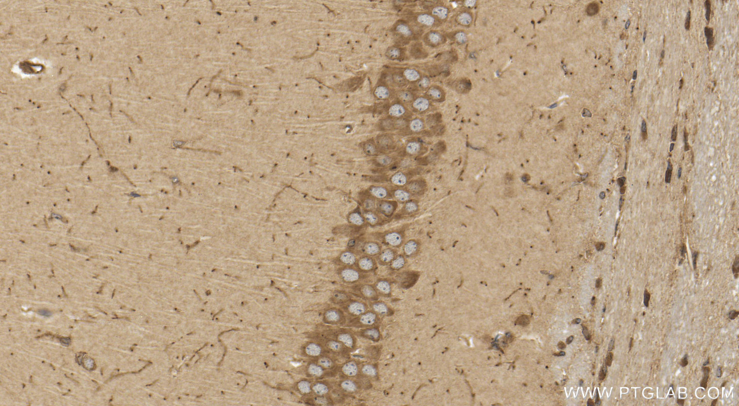 IHC staining of mouse brain using 13726-1-AP