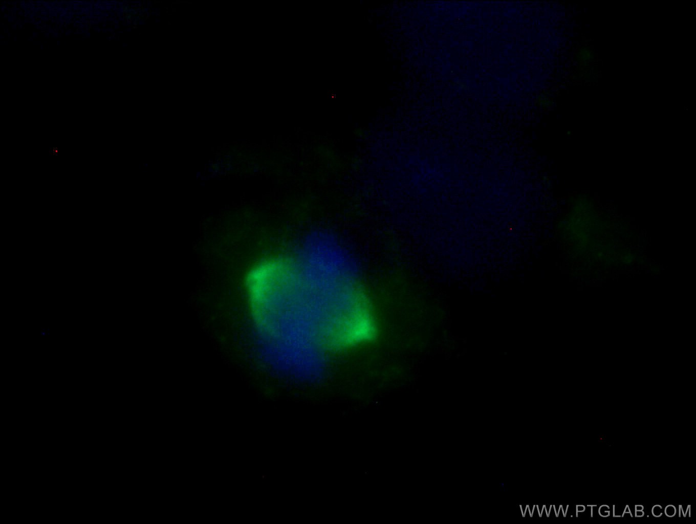 IF Staining of HeLa using 10297-1-AP