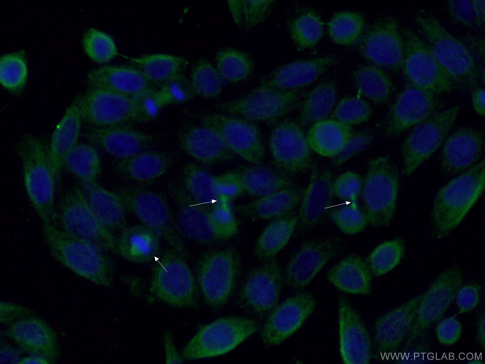 IF Staining of HeLa using 66757-1-Ig