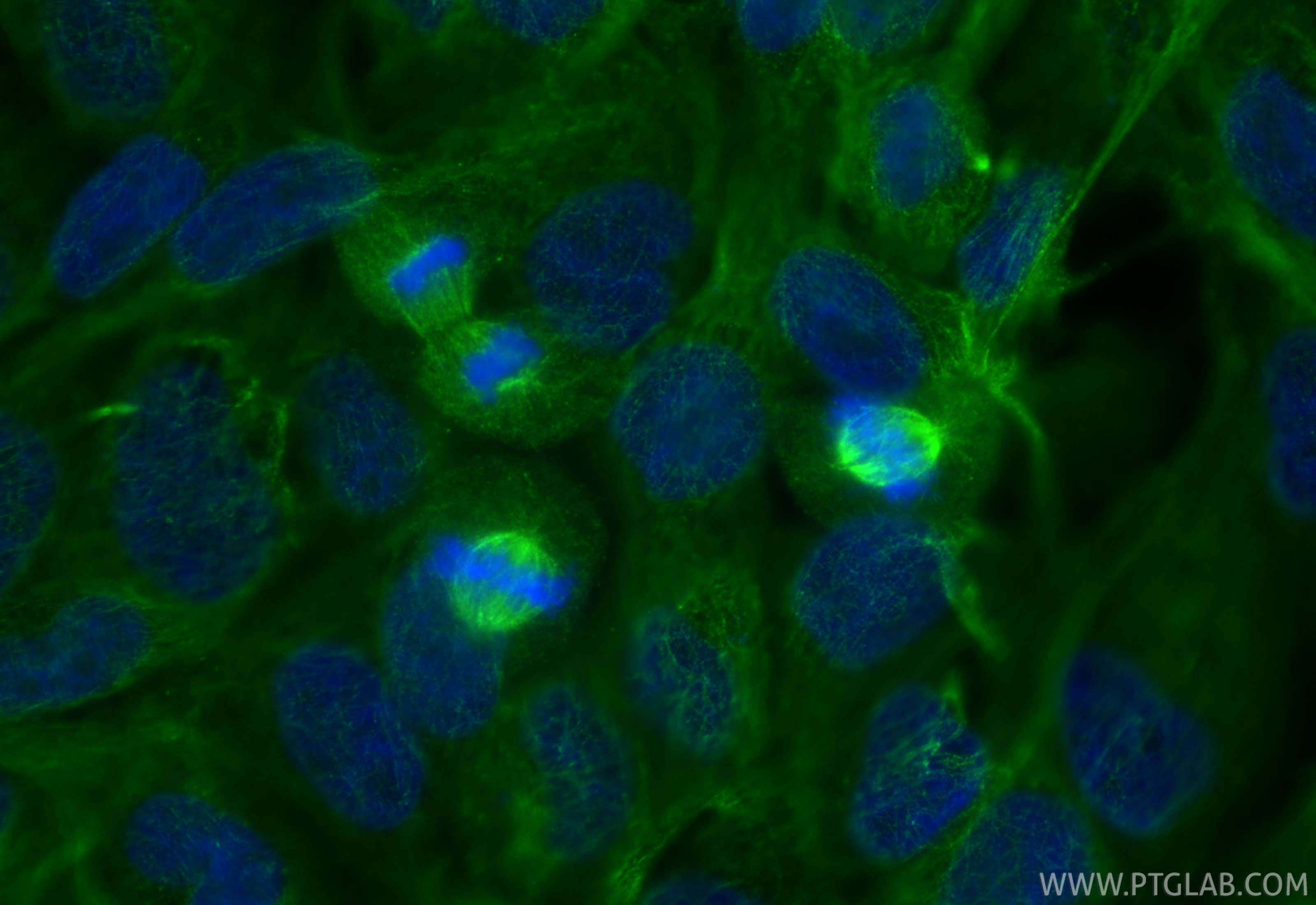 Immunofluorescent analysis of (4% PFA) fixed A431 cells using AURKA antibody (66757-1-Ig, Clone: 1F4B10 ) at dilution of 1:500 and CoraLite®488-Conjugated Goat Anti-Mouse IgG(H+L) (<a class='green' href='/productredirect?CatalogNo=SA00013-1' target='_blank'>SA00013-1</a>). IF Staining of A431 using 66757-1-Ig