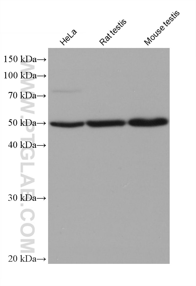 WB analysis using 66757-1-Ig