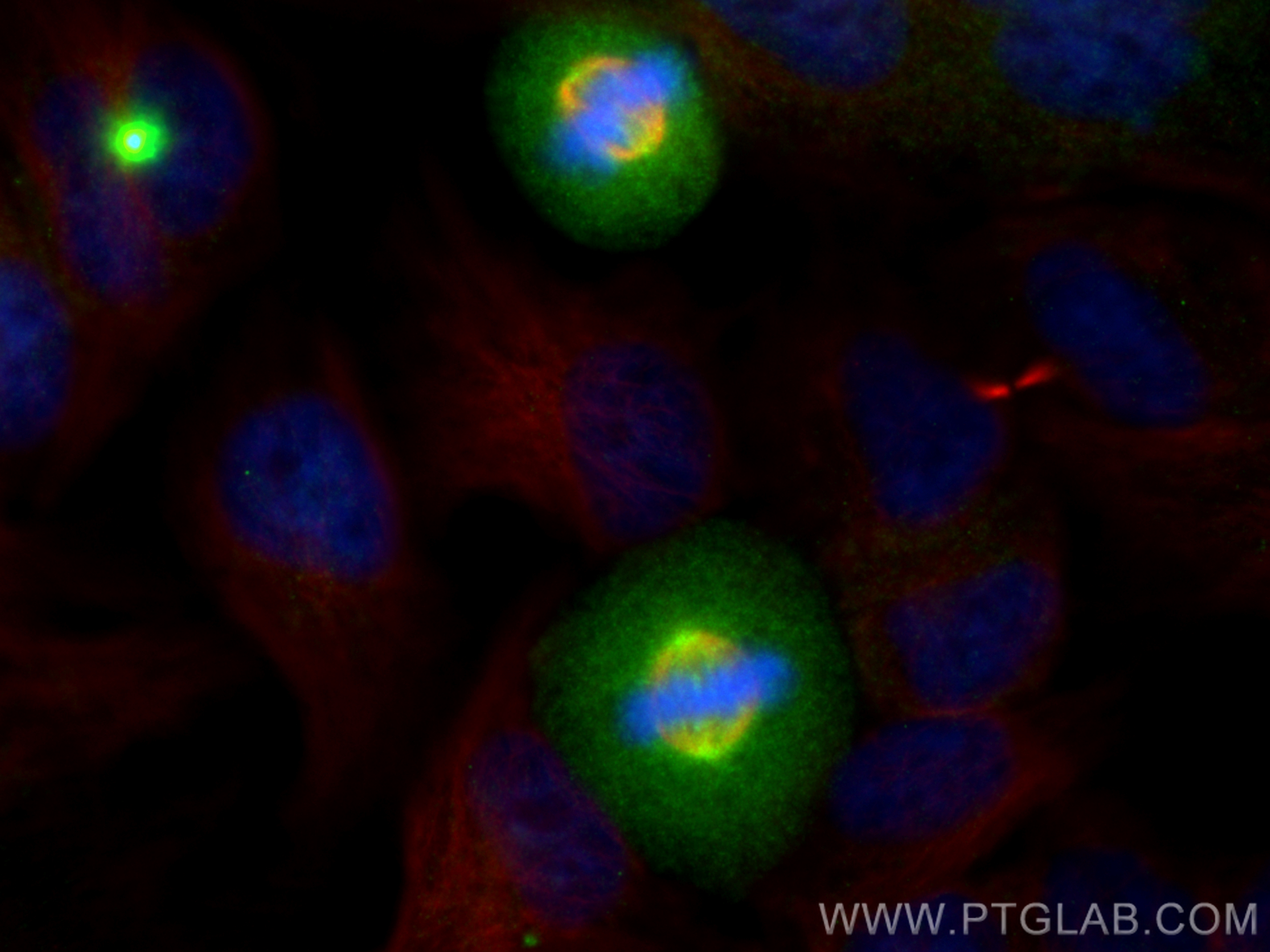 IF Staining of HeLa using 82906-1-RR
