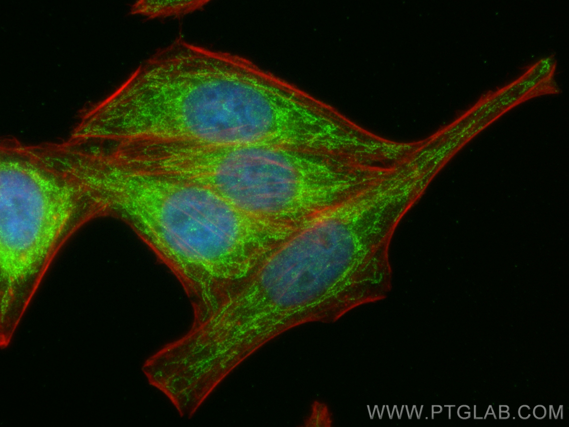 IF Staining of HepG2 using 17528-1-AP