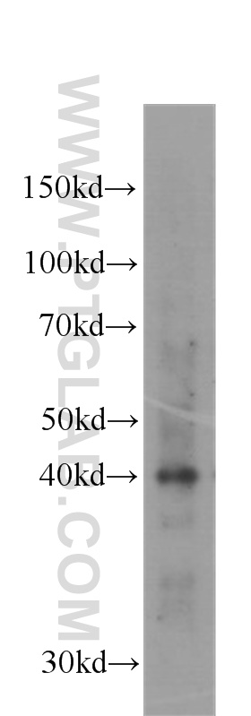 WB analysis of HeLa using 60098-1-Ig