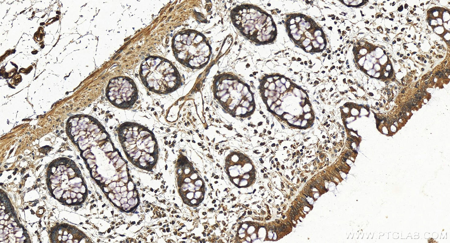 Immunohistochemical analysis of paraffin-embedded human colon tissue slide using 25846-1-AP (AVEN antibody) at dilution of 1:200 (under 20x lens). Heat mediated antigen retrieval with Tris-EDTA buffer (pH 9.0). IHC staining of human colon using 25846-1-AP