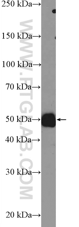 WB analysis of MCF-7 using 25846-1-AP