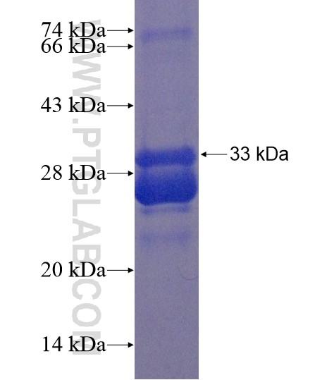 AWAT1 fusion protein Ag20183 SDS-PAGE AWAT1 fusion protein Ag20183 SDS-PAGE