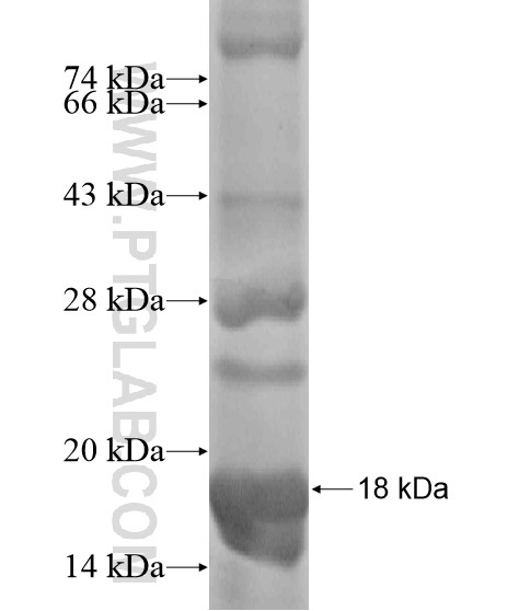 AWAT2 fusion protein Ag19030 SDS-PAGE AWAT2 fusion protein Ag19030 SDS-PAGE