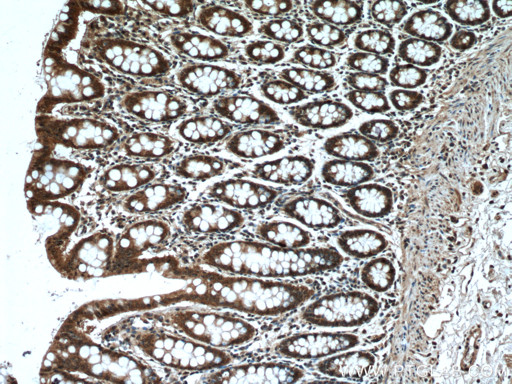 IHC staining of human colon using 16541-1-AP