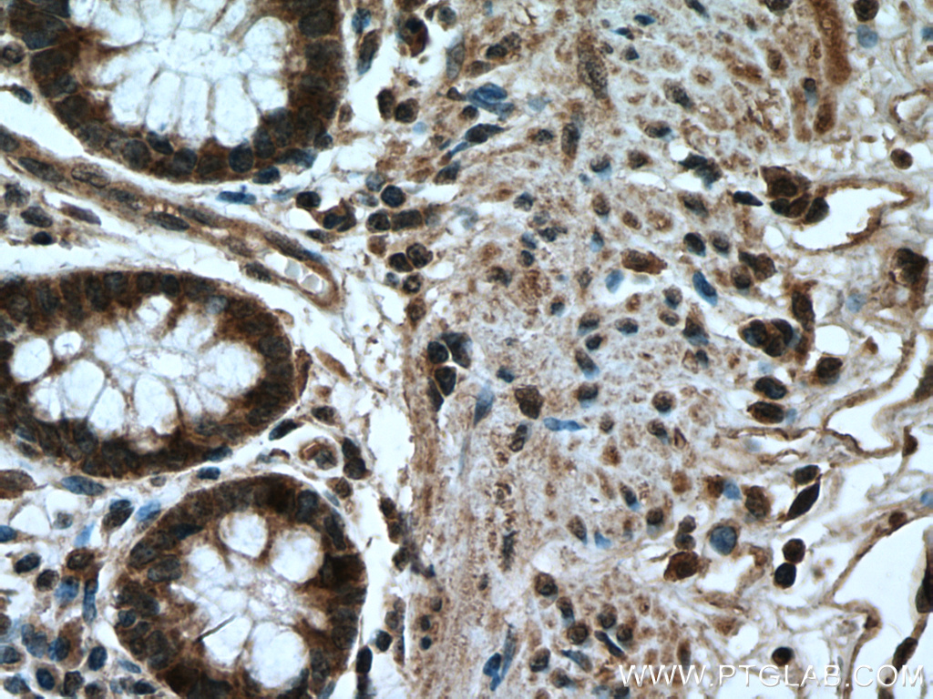 IHC staining of human colon using 16541-1-AP
