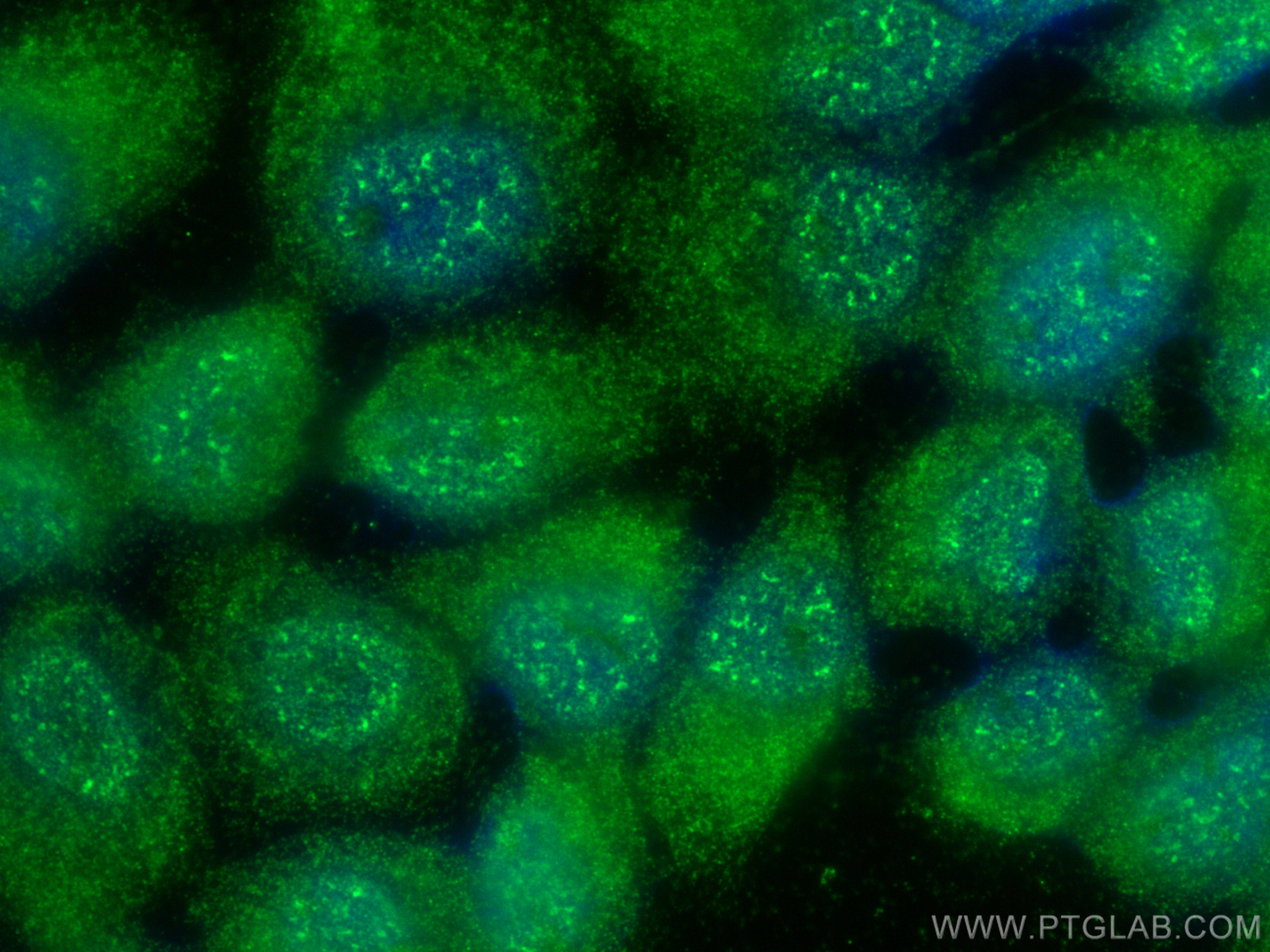 IF Staining of A431 using 68093-1-Ig (same clone as 68093-1-PBS)