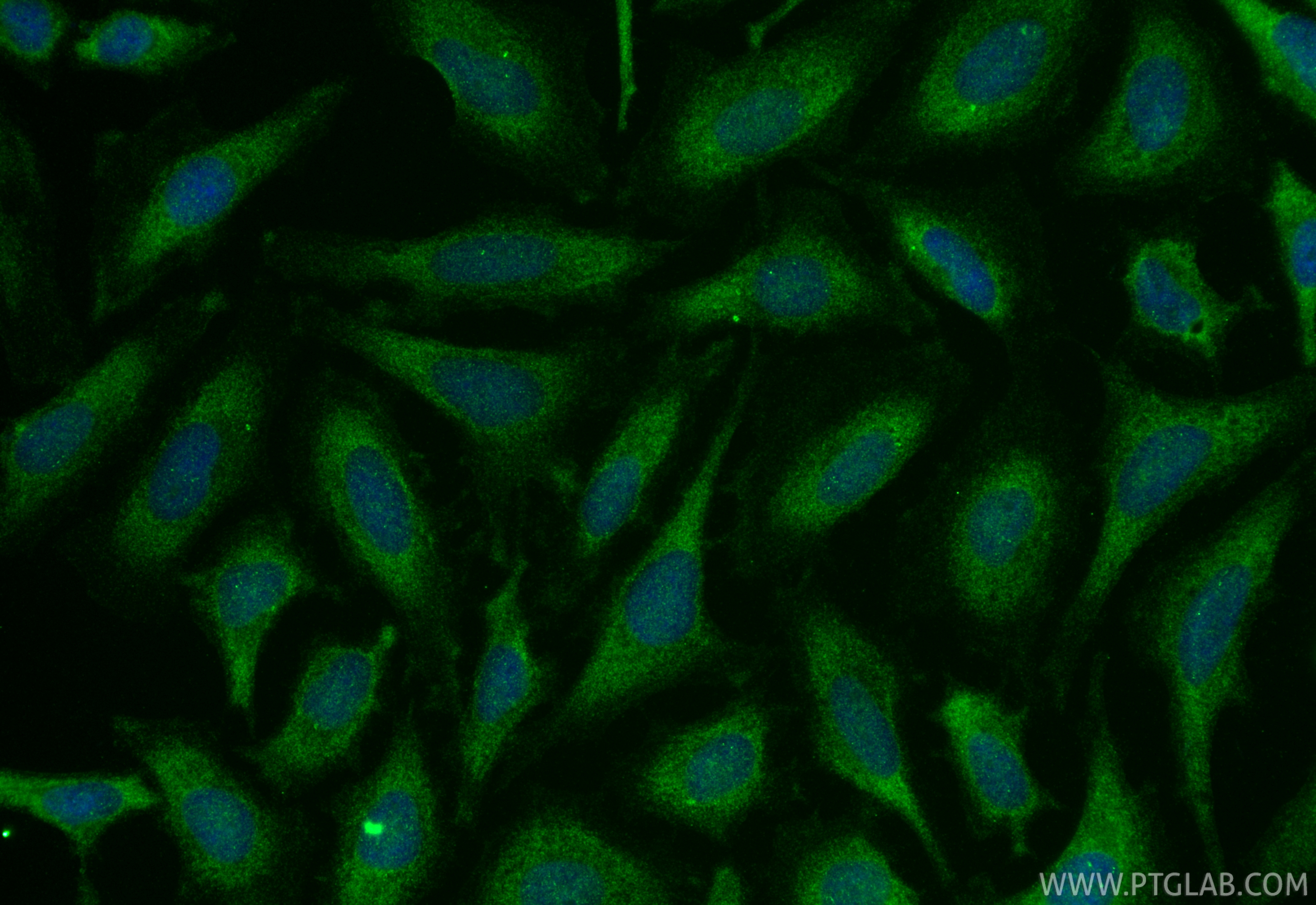 IF Staining of HeLa using 20540-1-AP
