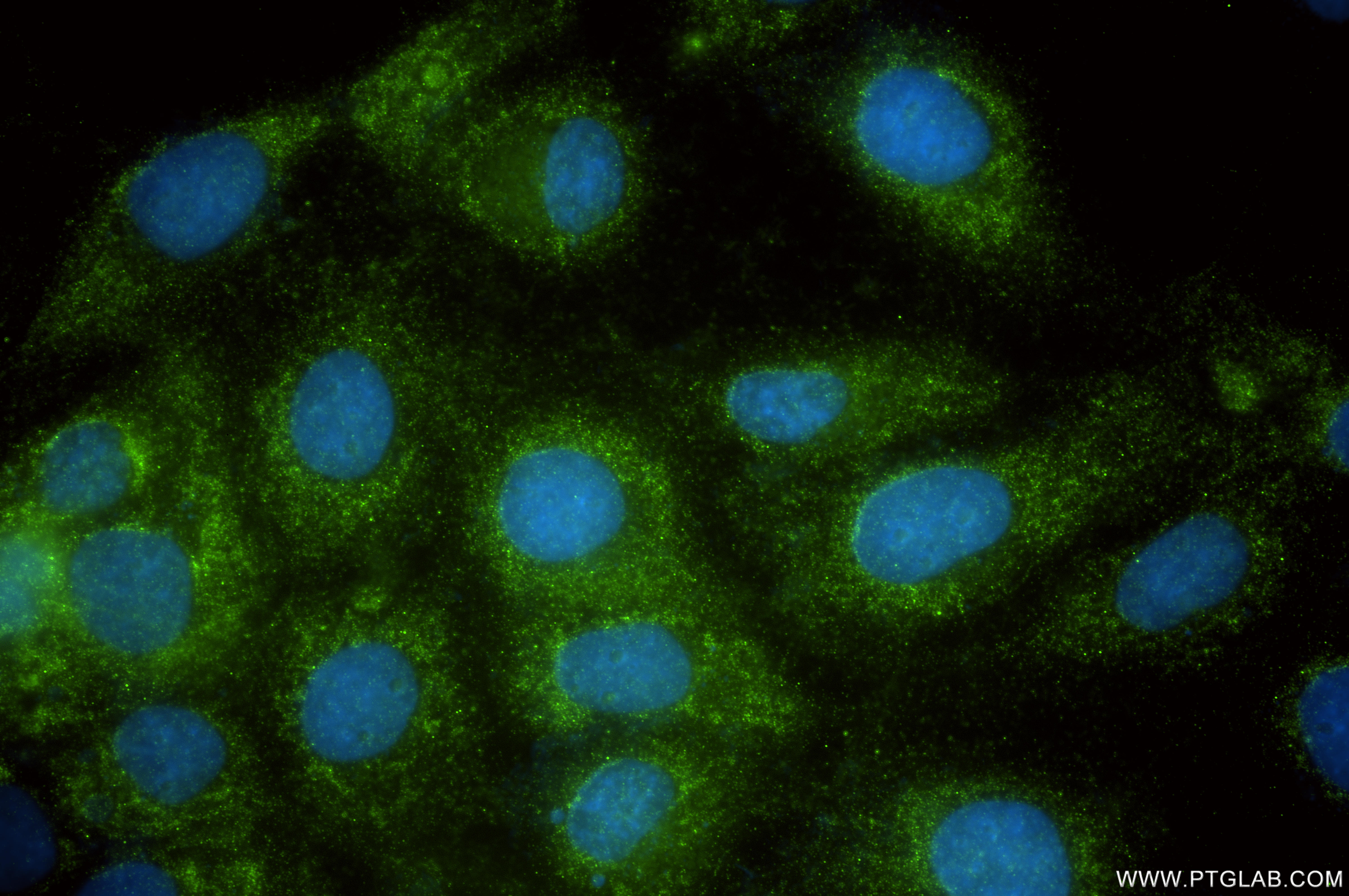 IF Staining of A431 using 83631-2-RR IF Staining of A431 using 83631-2-RR