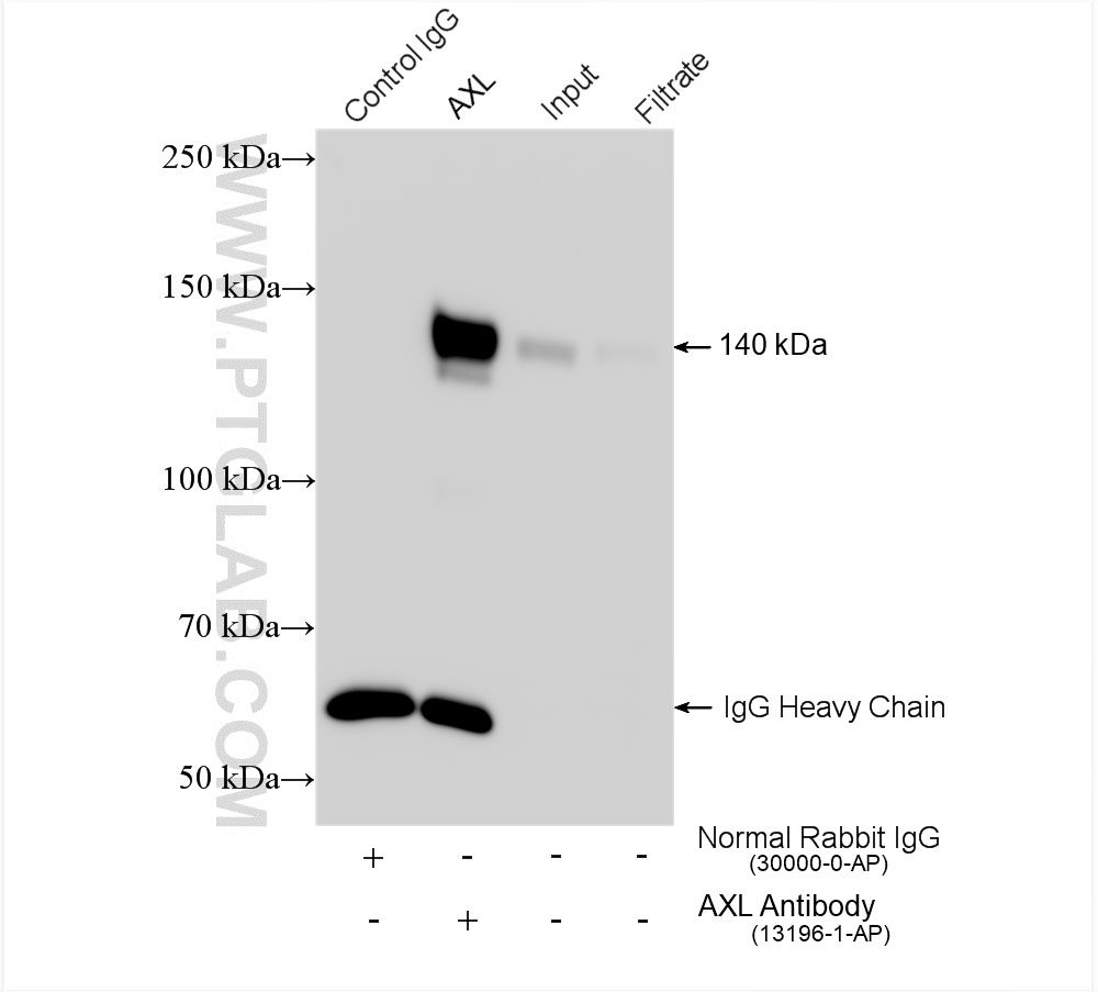 IP experiment of HeLa using 13196-1-AP