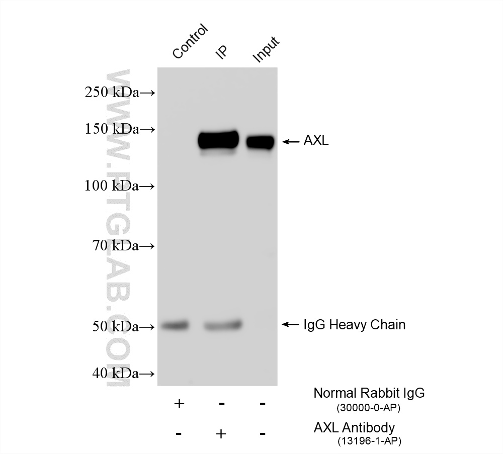 IP result of anti-AXL (IP:13196-1-AP, 4ug; Detection:13196-1-AP 1:2000) with HeLa cells lysate 920 ug. IP experiment of HeLa using 13196-1-AP