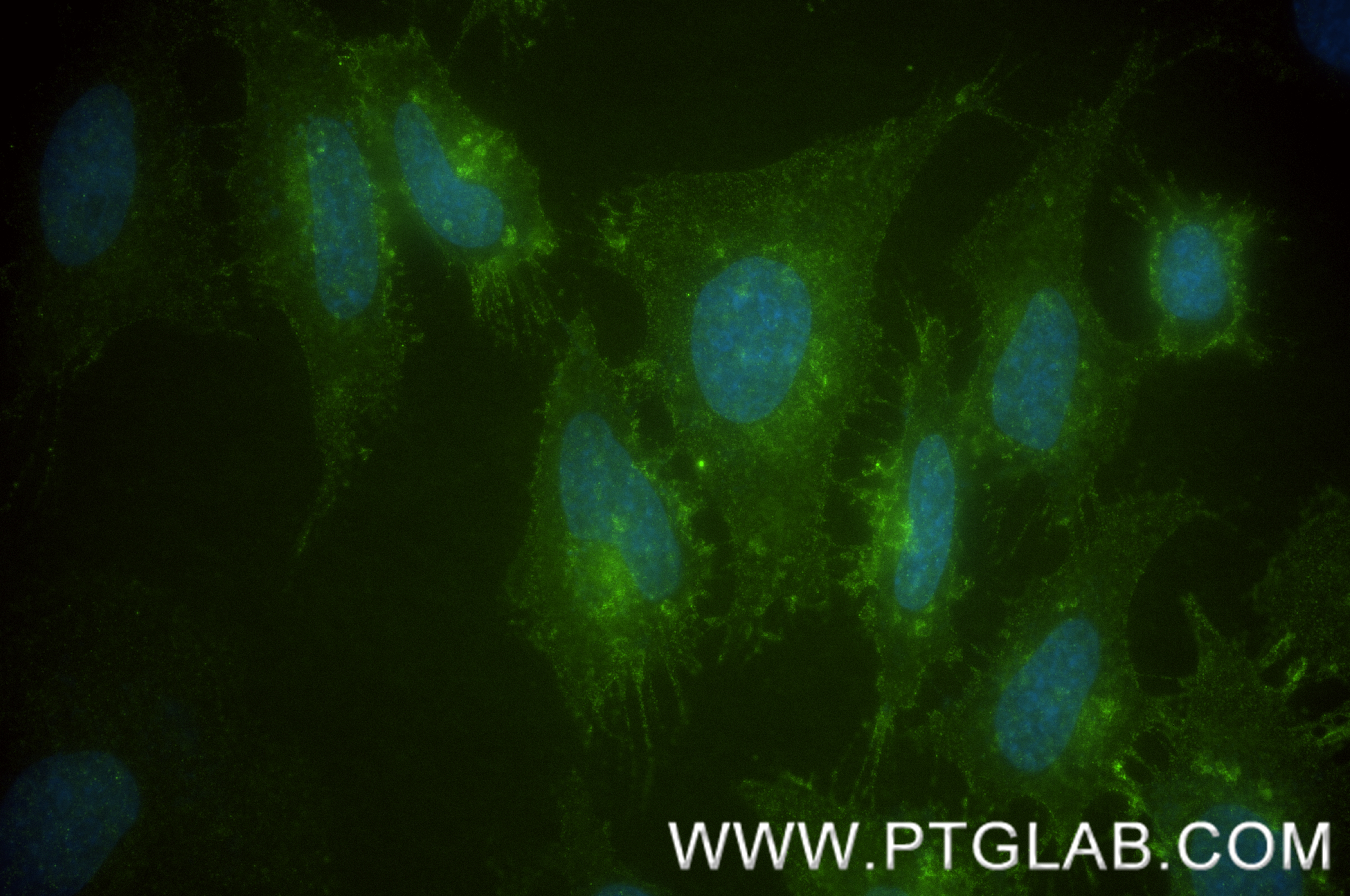 IF Staining of HeLa using 84659-1-RR (same clone as 84659-1-PBS)