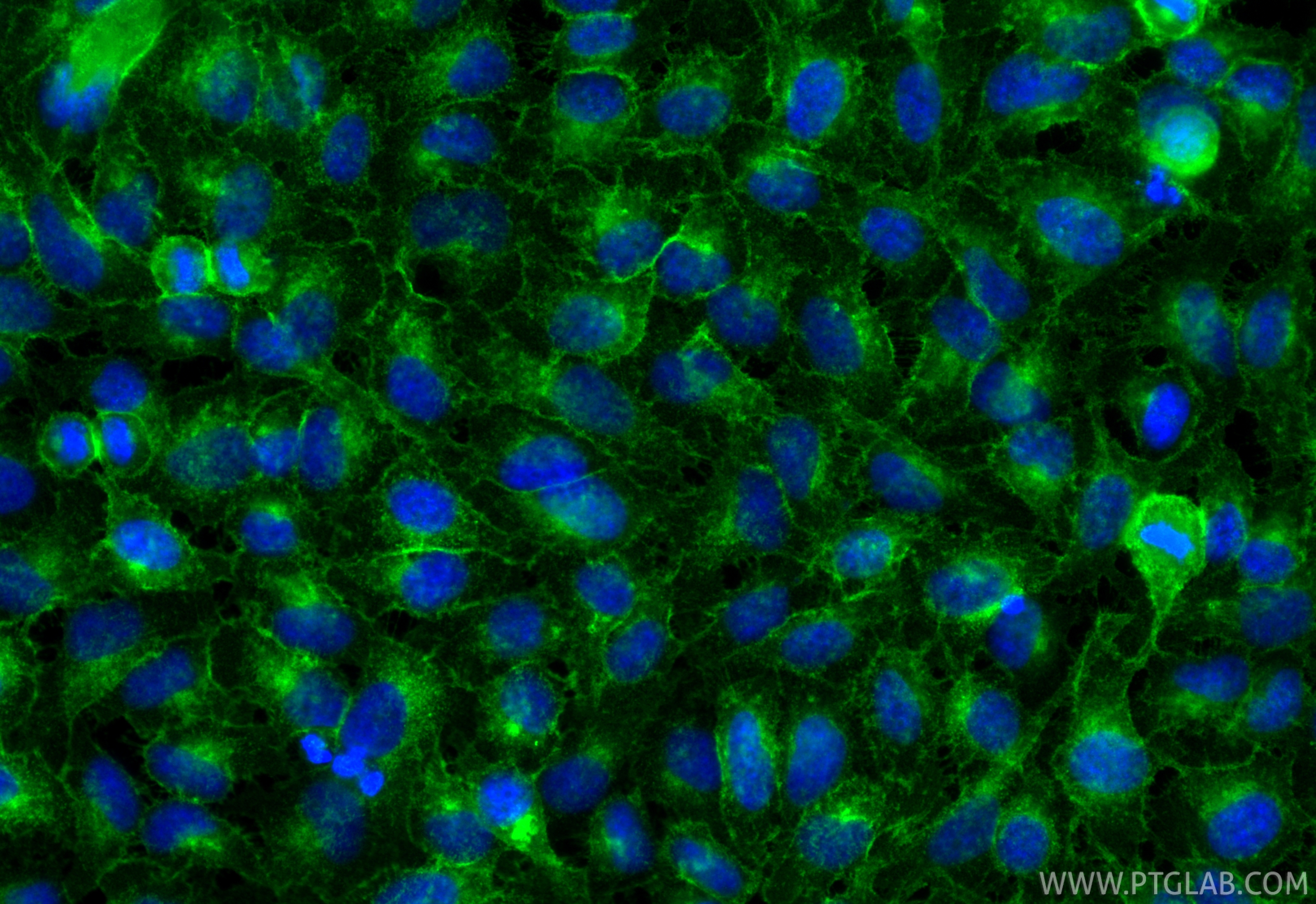 IF Staining of HeLa using RMX00064 IF Staining of HeLa using RMX00064