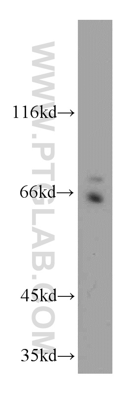 WB analysis of HeLa using 18162-1-AP