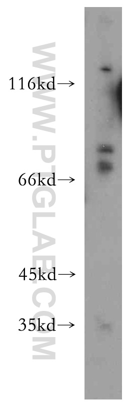 WB analysis of mouse thymus using 18162-1-AP