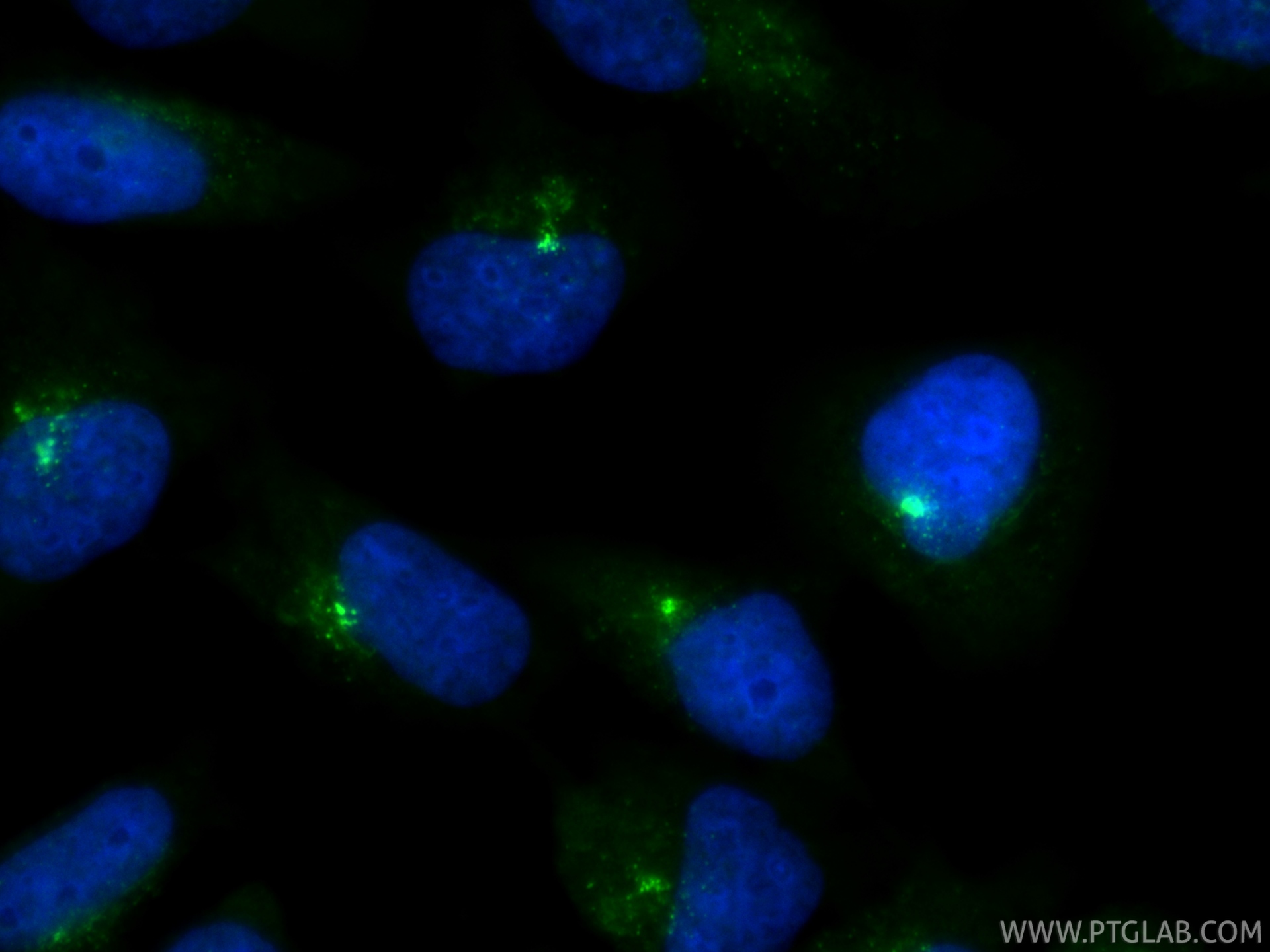 IF Staining of HeLa using 25735-1-AP