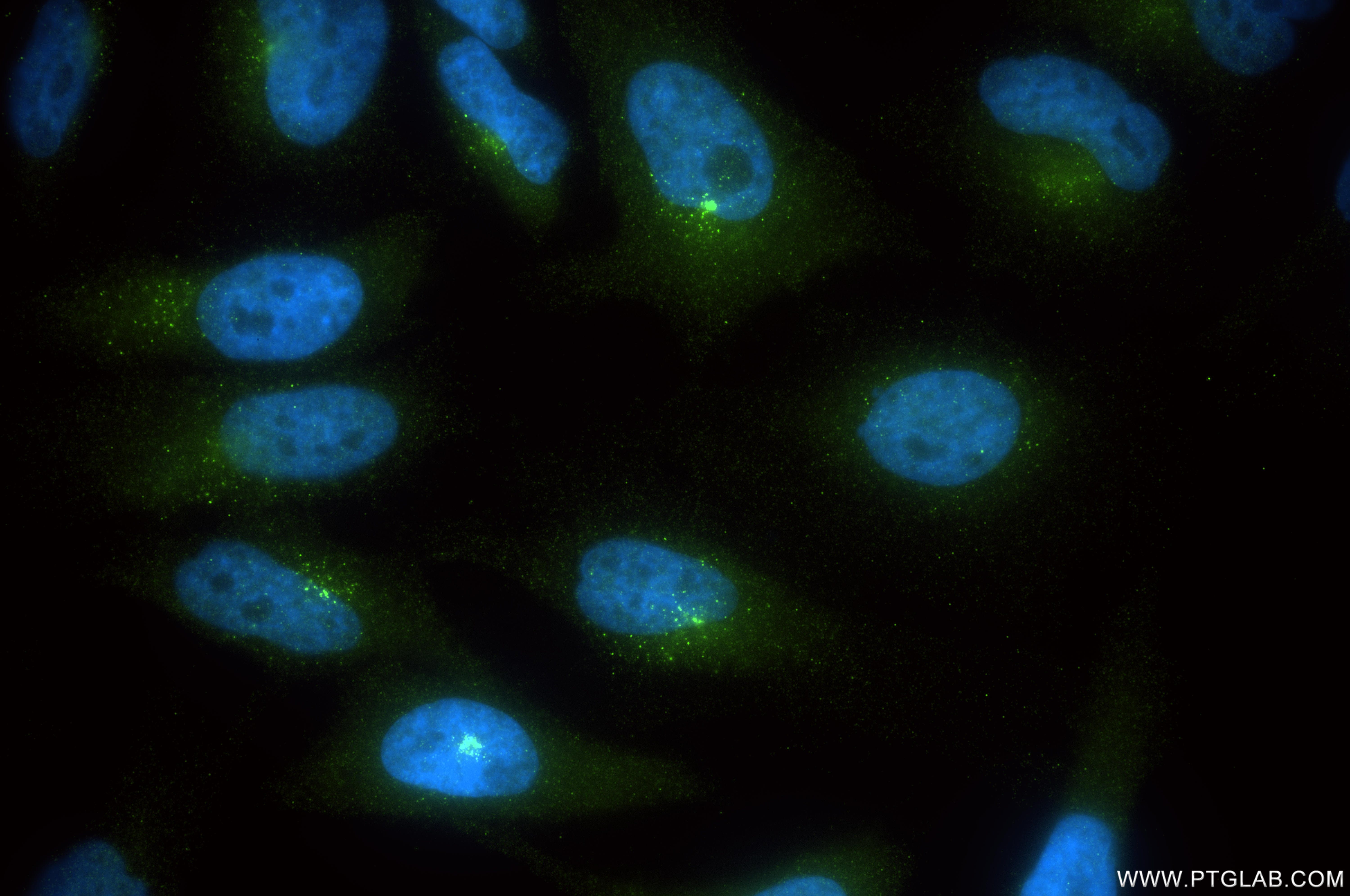 Immunofluorescent analysis of (4% PFA) fixed HeLa cells using AZI1 antibody (86809-3-RR, Clone: 251839D3 ) at dilution of 1:500 and CoraLite®488-Conjugated Goat Anti-Rabbit IgG(H+L) (<a class='green' href='/productredirect?CatalogNo=SA00013-2' target='_blank'>SA00013-2</a>). IF Staining of HeLa using 86809-3-RR