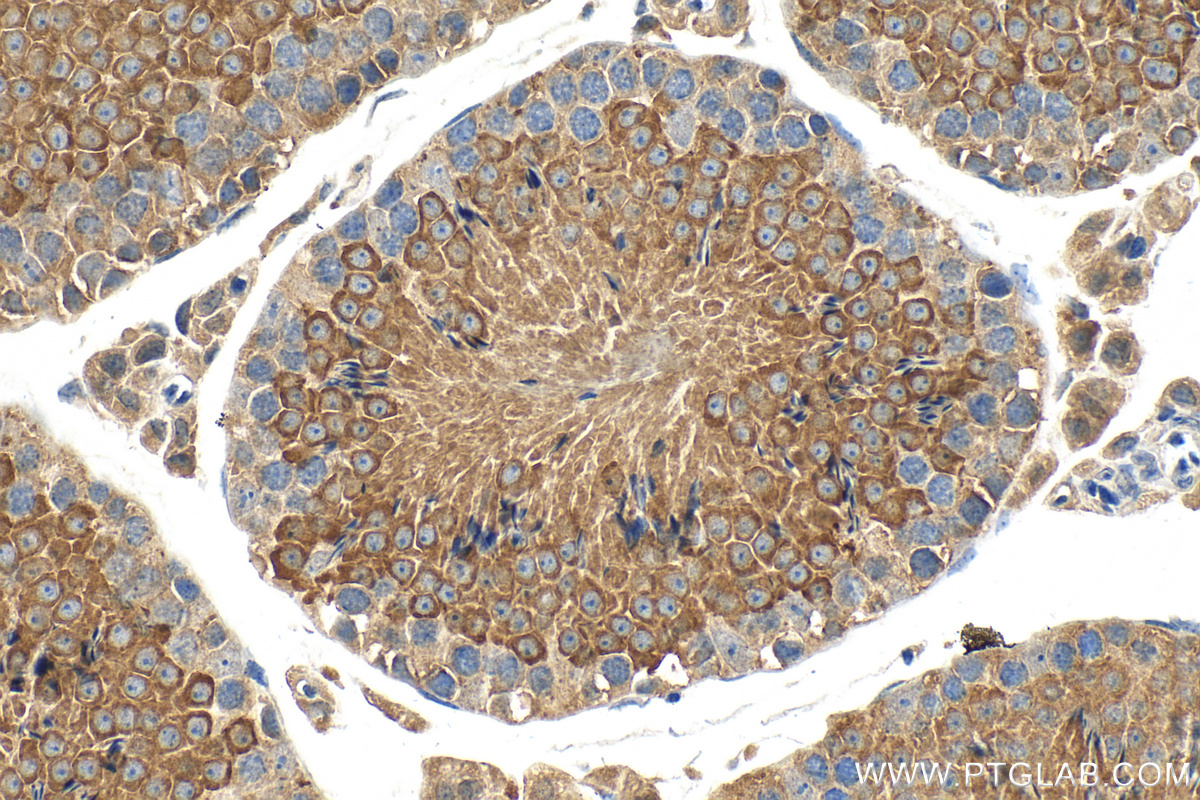 IHC staining of mouse testis using 15042-1-AP