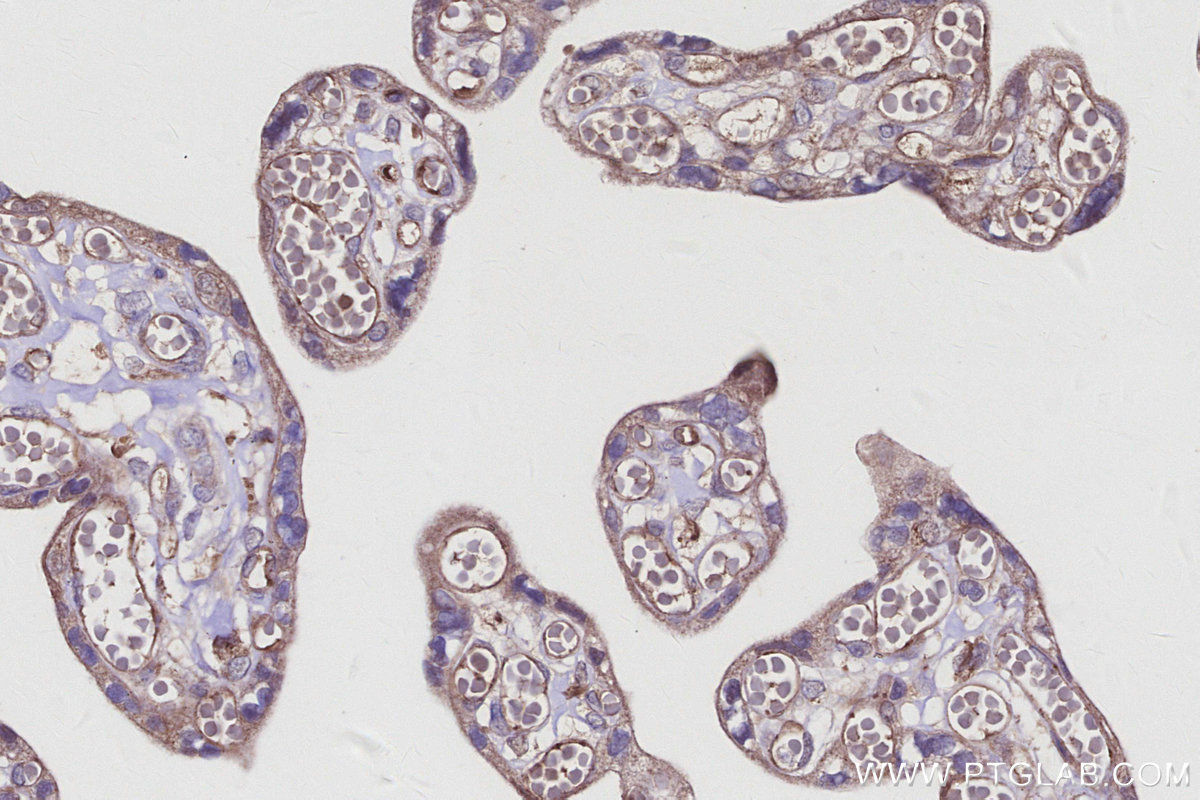 IHC staining of human placenta using 15042-1-AP IHC staining of human placenta using 15042-1-AP