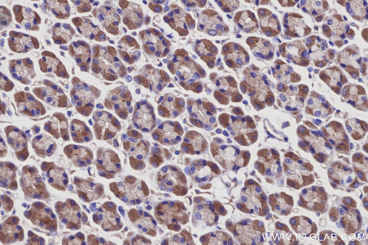 IHC staining of rat stomach using 15042-1-AP IHC staining of rat stomach using 15042-1-AP
