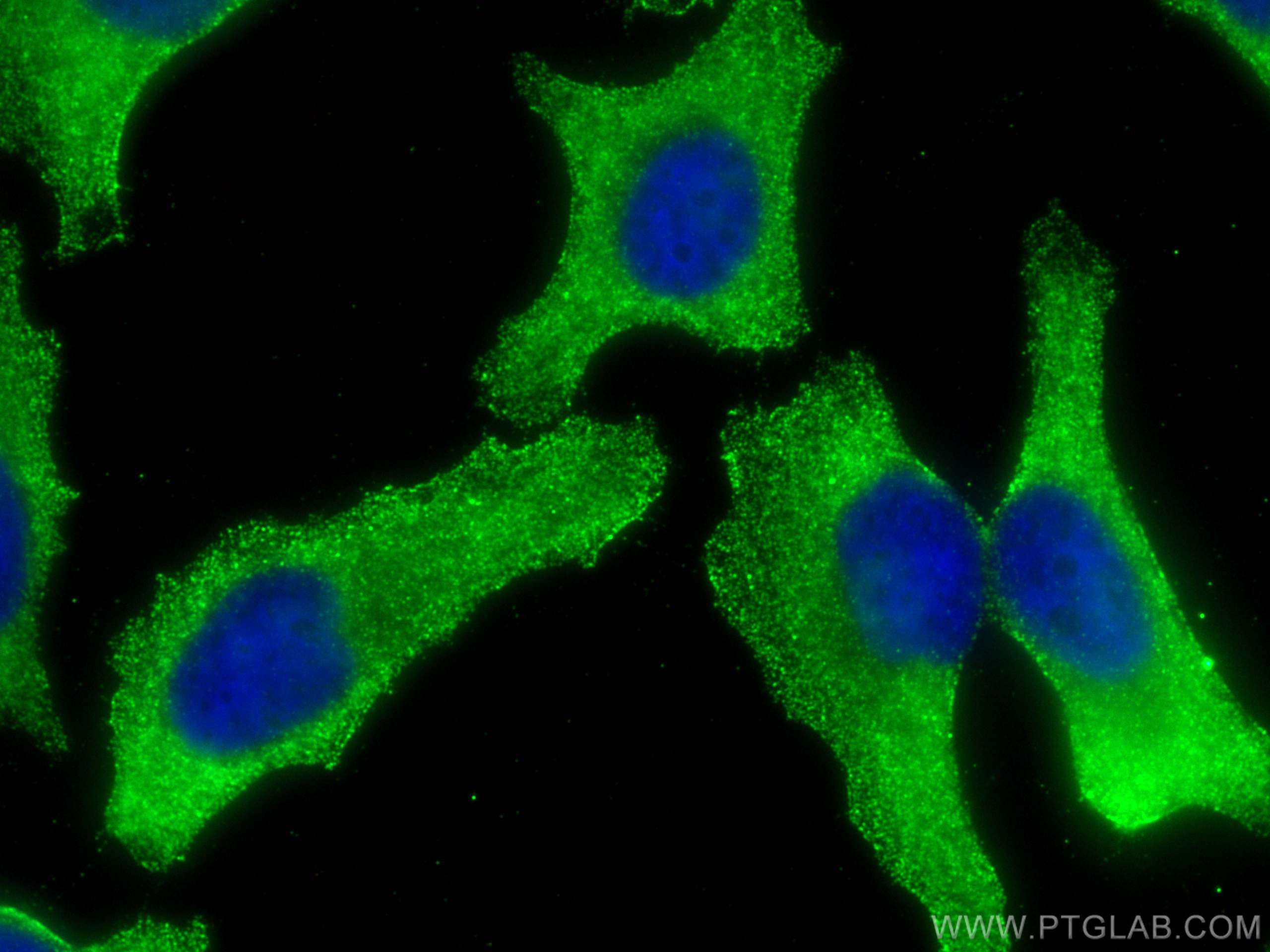 IF Staining of HeLa using 68326-1-Ig (same clone as 68326-1-PBS)