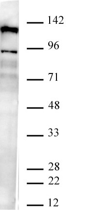 AbFlex JMJD2B / KDM4B antibody (rAb) tested by Western blot. 20 ug of K562 nuclear extract was run on SDS-PAGE and probed with AbFlex JMJD2B / KDM4B antibody at 2 ug/ml.