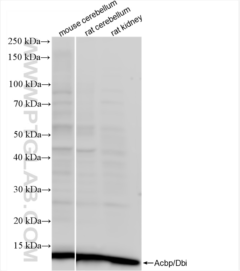 WB analysis using 84863-5-RR (same clone as 84863-5-PBS)
