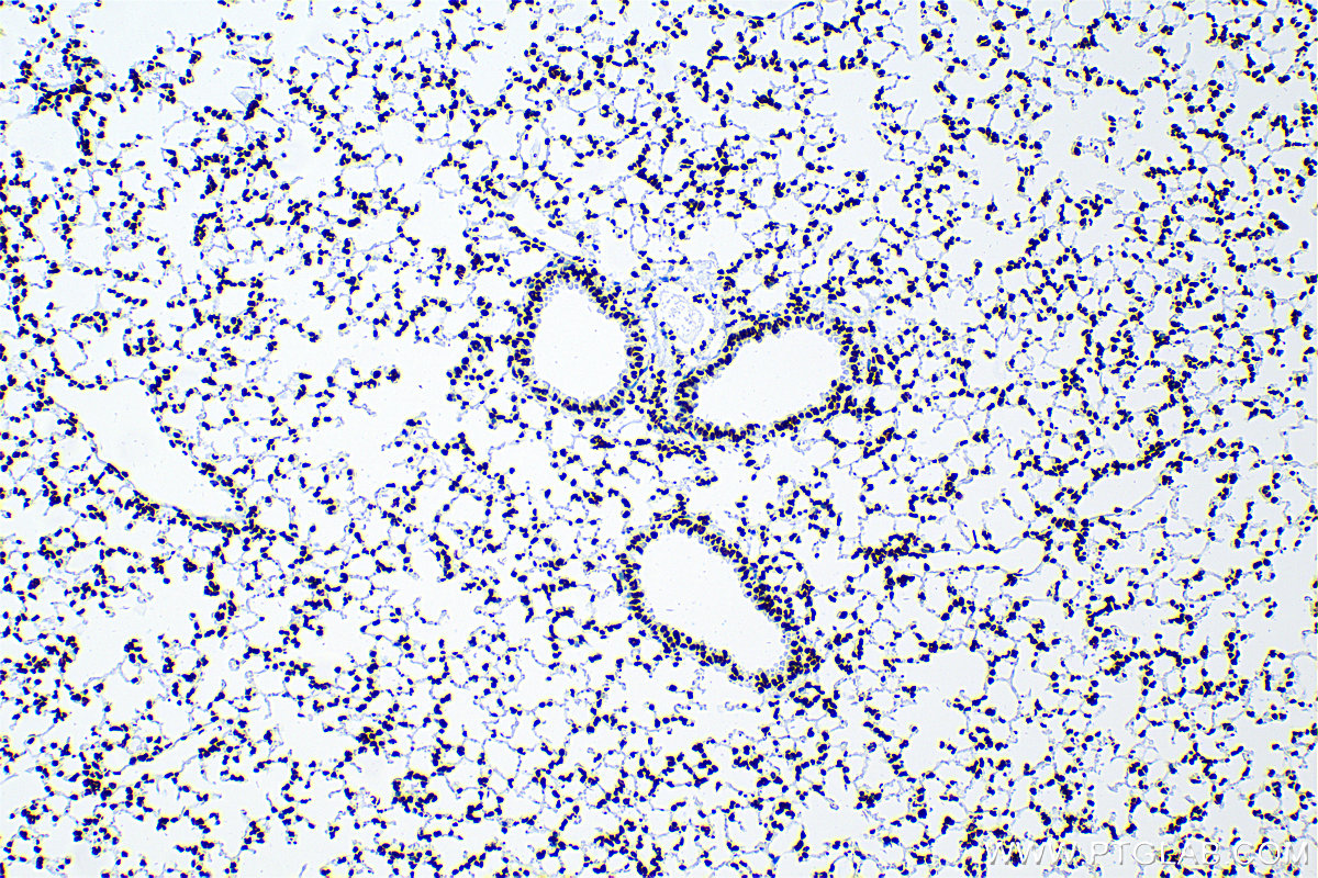 IHC staining of mouse lung using 83041-1-RR (same clone as 83041-1-PBS)