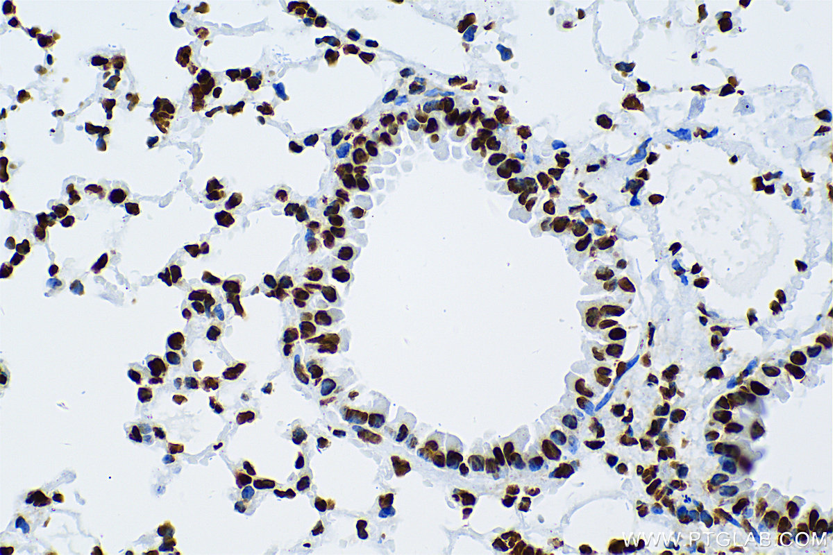 IHC staining of mouse lung using 83041-1-RR (same clone as 83041-1-PBS)