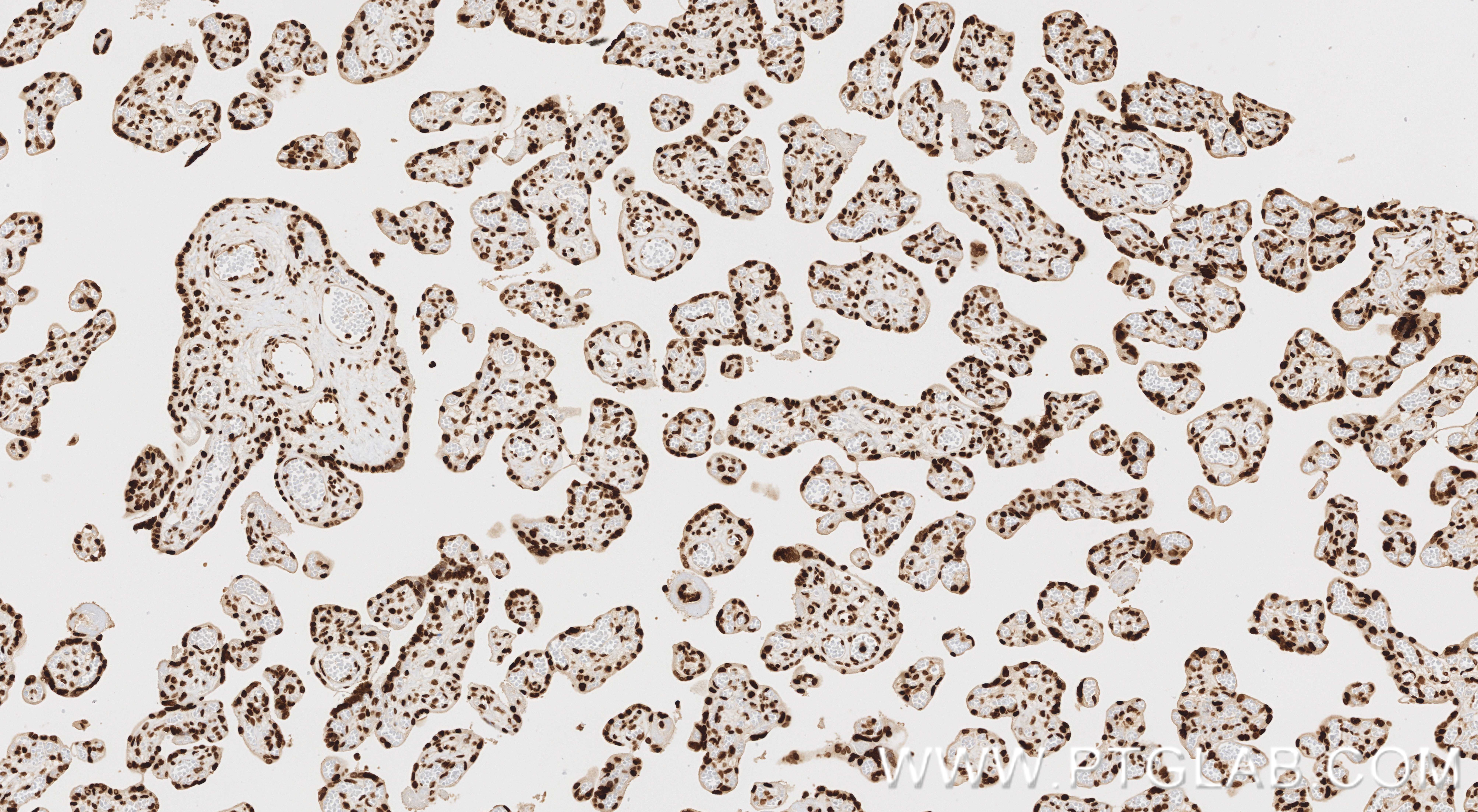 IHC staining of human placenta using 86731-1-RR (same clone as 86731-1-PBS) IHC staining of human placenta using 86731-1-RR (same clone as 86731-1-PBS)