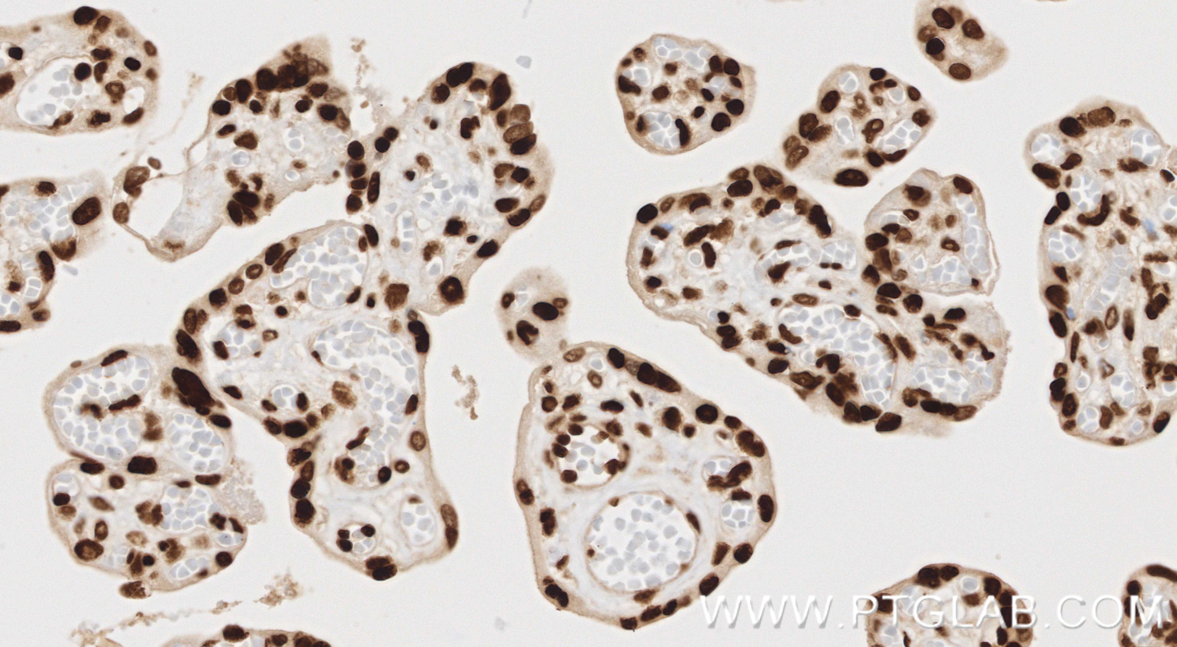 IHC staining of human placenta using 86731-1-RR (same clone as 86731-1-PBS) IHC staining of human placenta using 86731-1-RR (same clone as 86731-1-PBS)