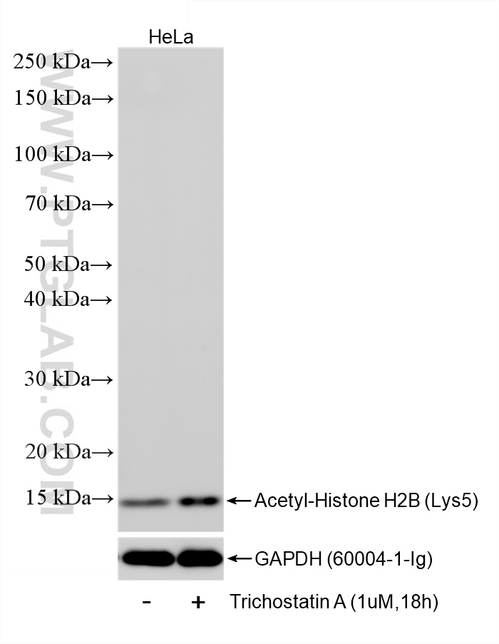 WB analysis of HeLa using 86731-1-RR (same clone as 86731-1-PBS) WB analysis of HeLa using 86731-1-RR (same clone as 86731-1-PBS)