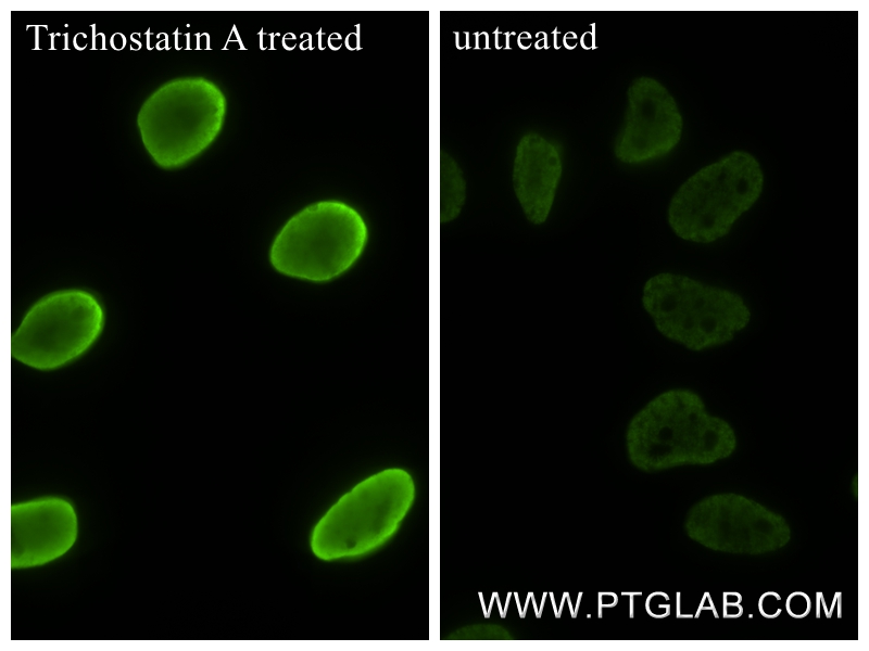IF Staining of HeLa using 83171-7-RR