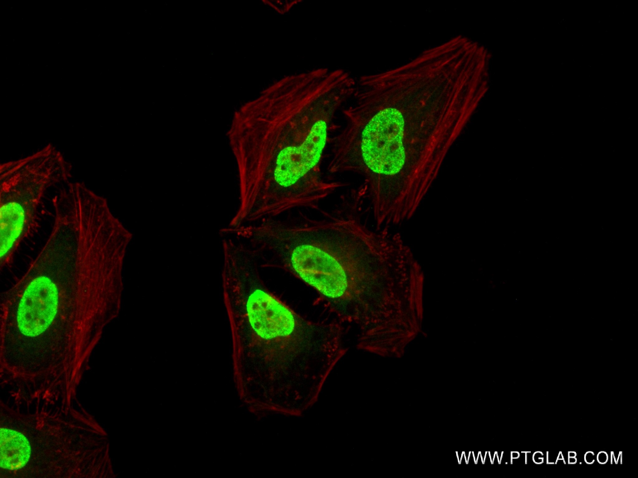 IF Staining of HeLa using 84446-1-RR