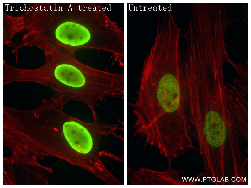 IF Staining of HeLa using 84446-1-RR