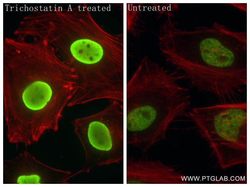 IF Staining of HeLa using 84549-1-RR