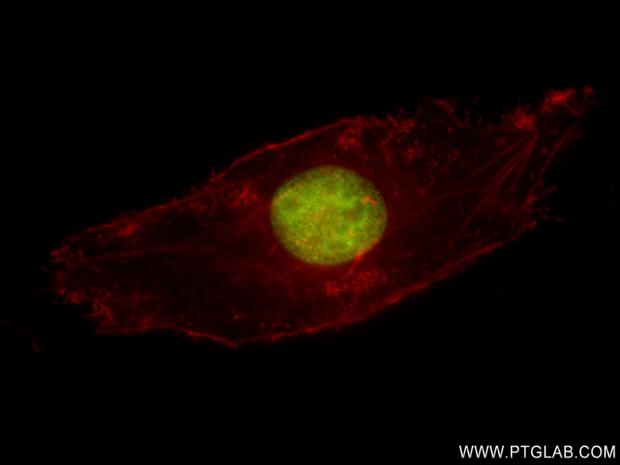 IF Staining of HeLa using 83171-4-RR