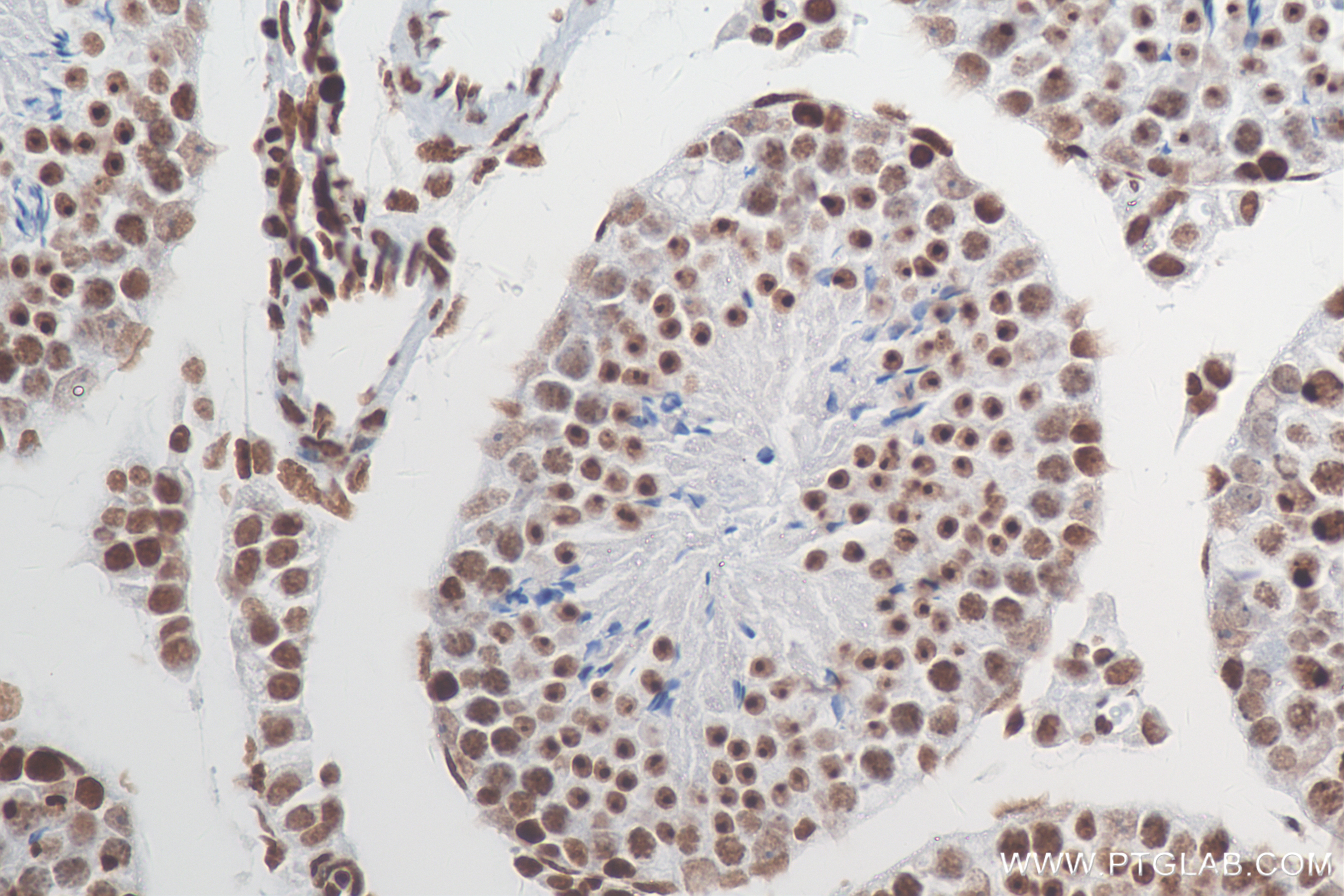 IHC staining of mouse testis using 82838-2-RR