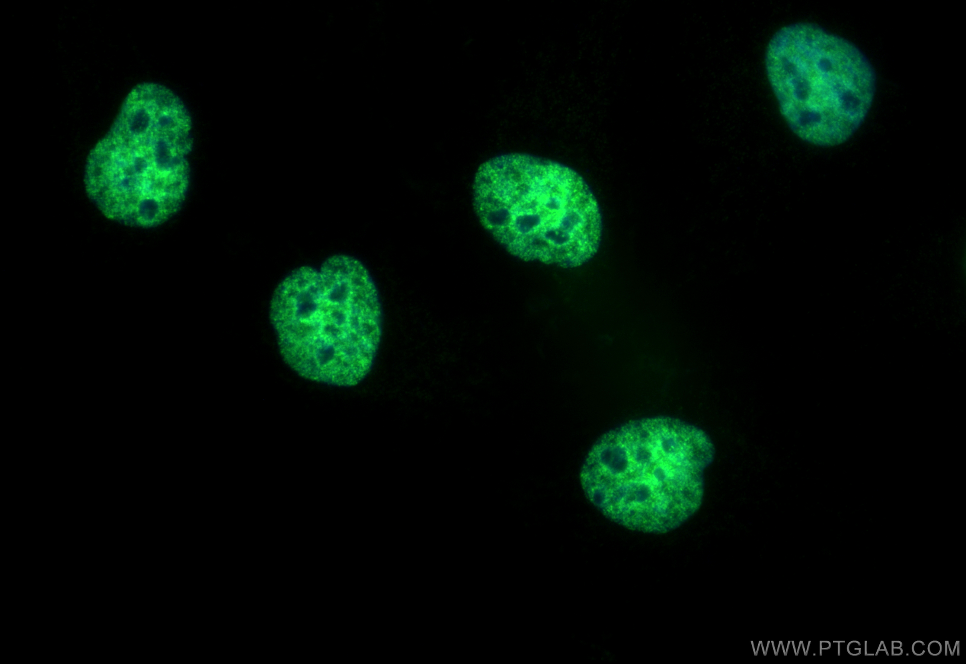 IF Staining of HeLa using CL488-82838-2