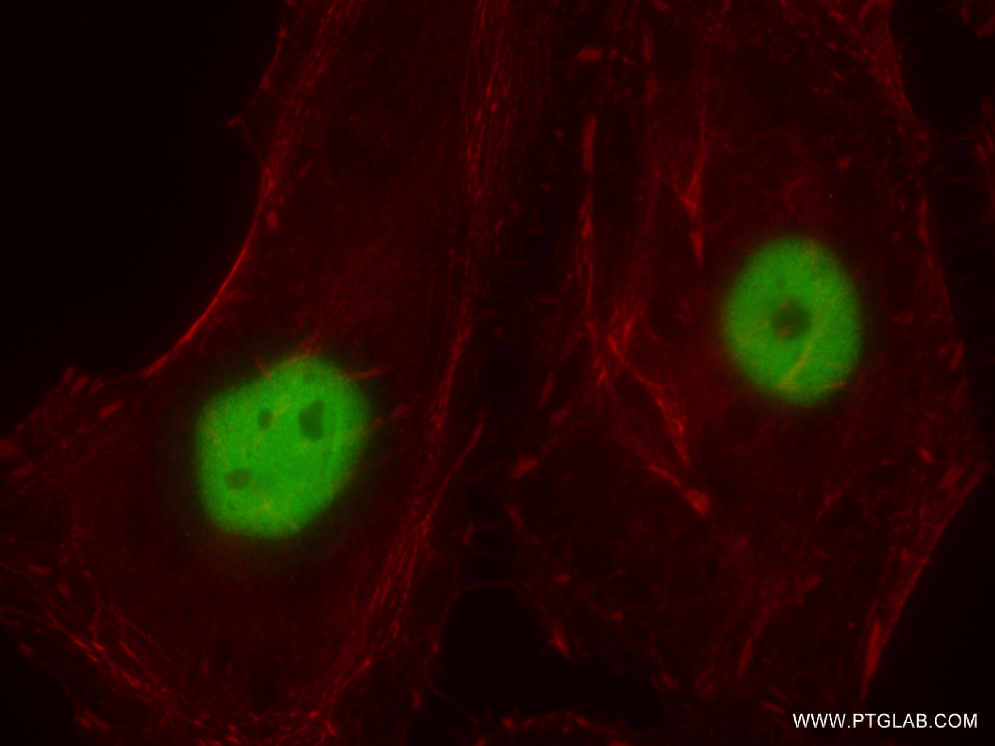 IF Staining of HeLa using 82902-1-RR (same clone as 82902-1-PBS)